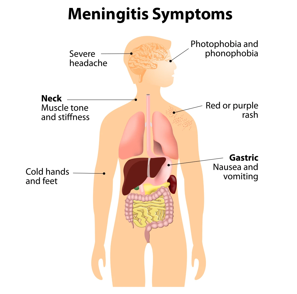 These are common symptoms of meningitis