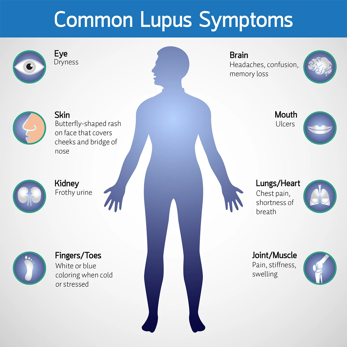 Lupus Advocate Health Care Lupus Advocate Health Care